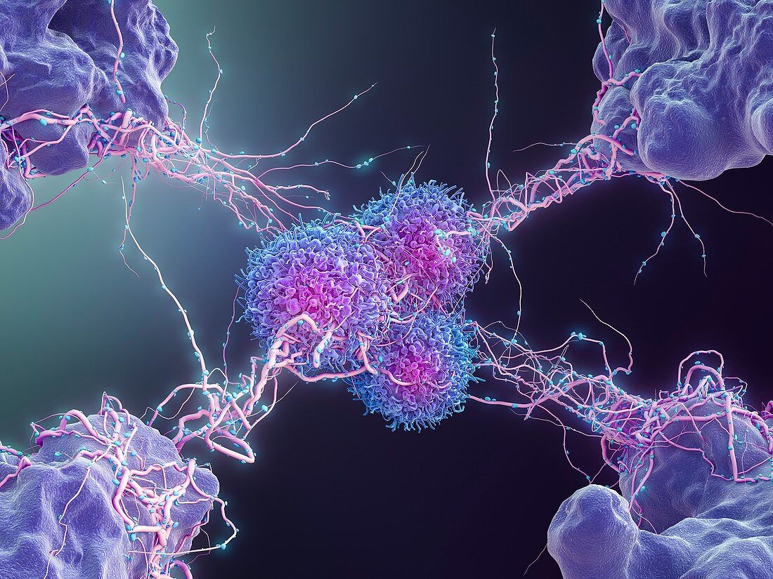 Cancer cells,illustration