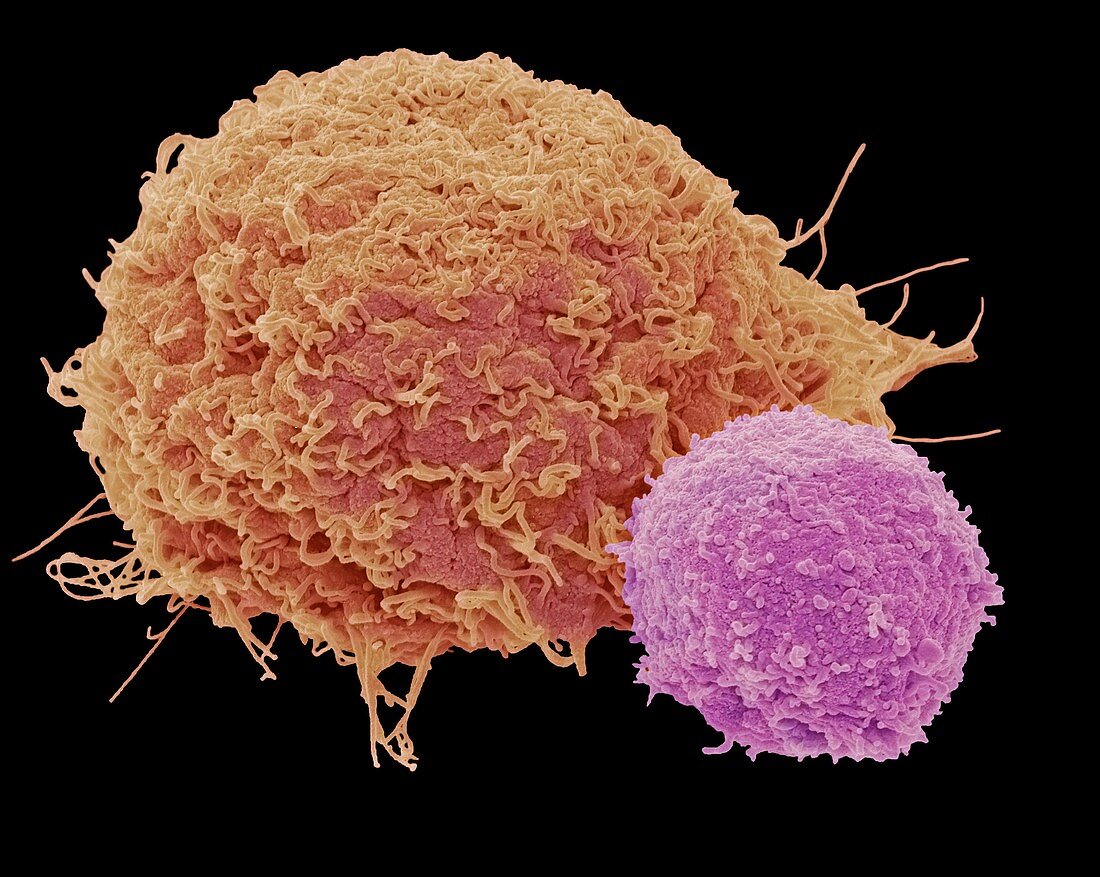 T lymphocyte and cancer cell,SEM