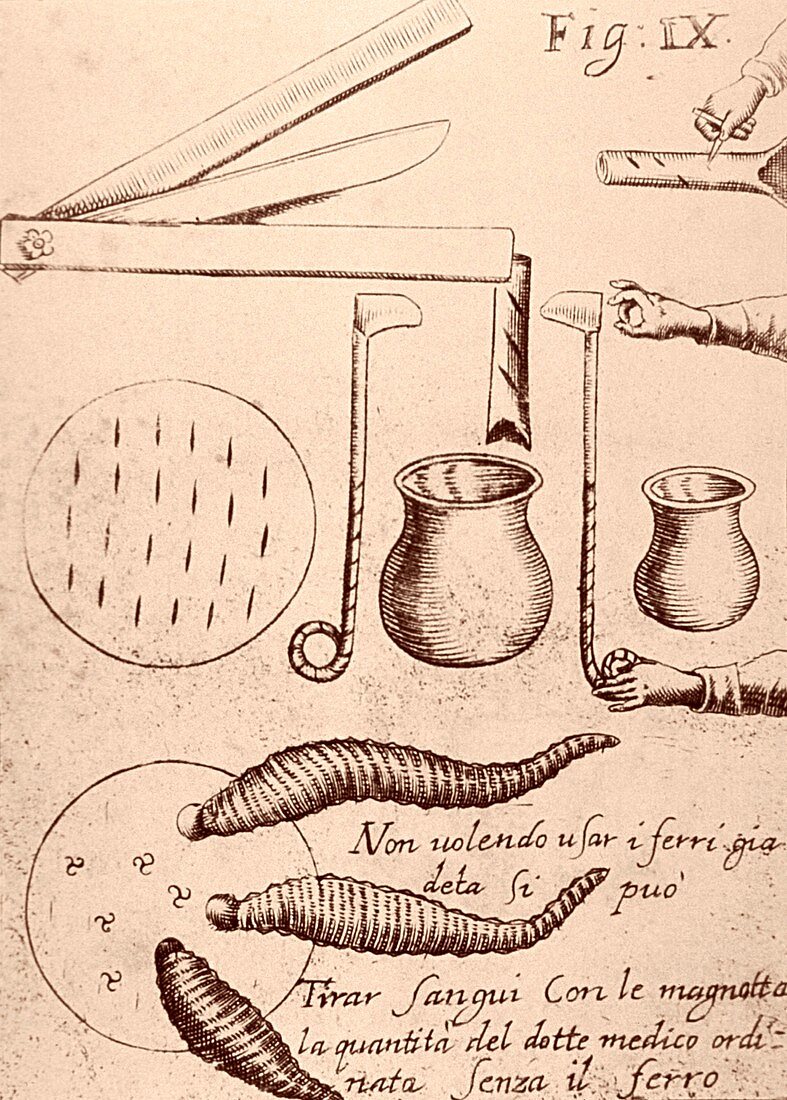 Blood-letting instruments,17th century