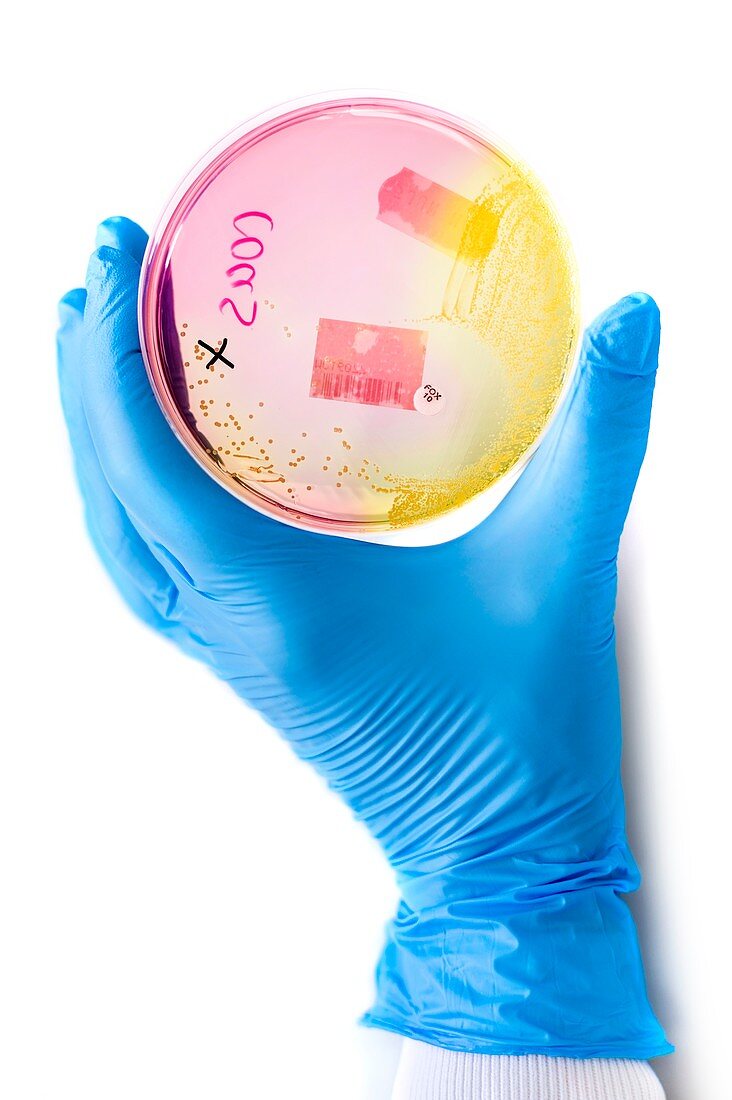 Cultured bacteria tested for MRSA