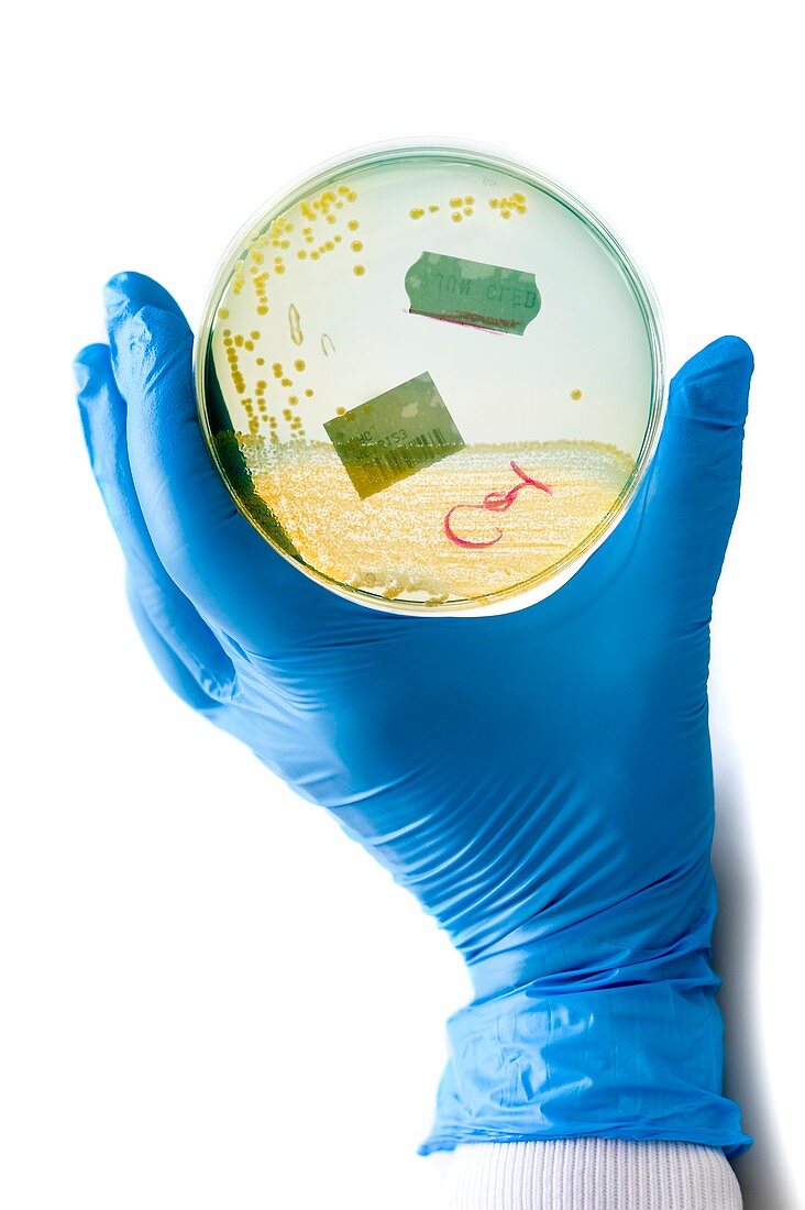 Cultured urinary bacteria