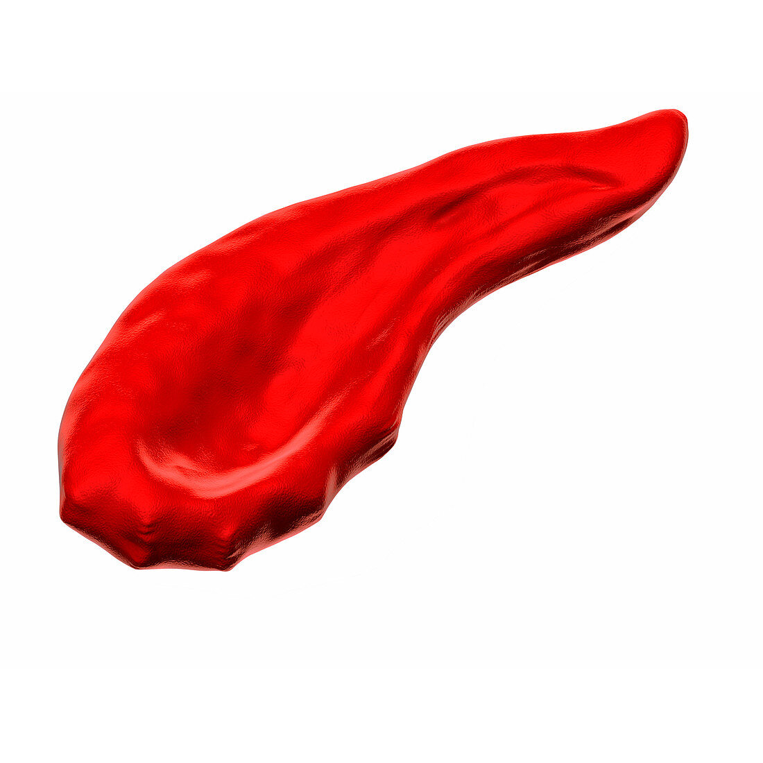 Sickle cell anaemia,illustration