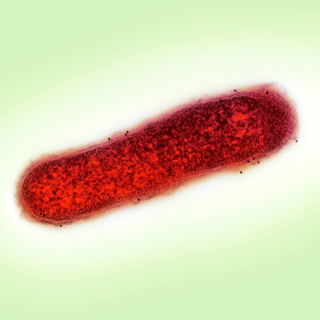 Cholera bacterium,TEM