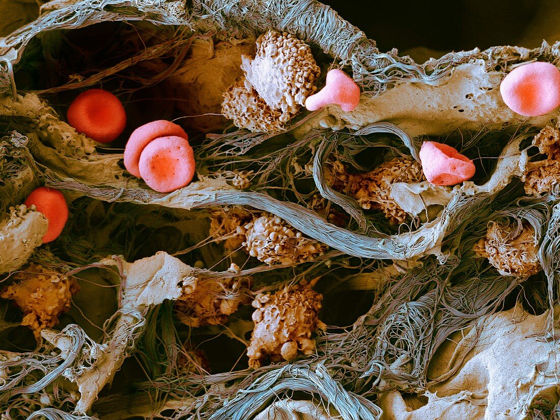 Cells in lung tissue,SEM
