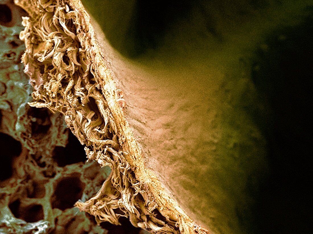 Lung tissue,SEM