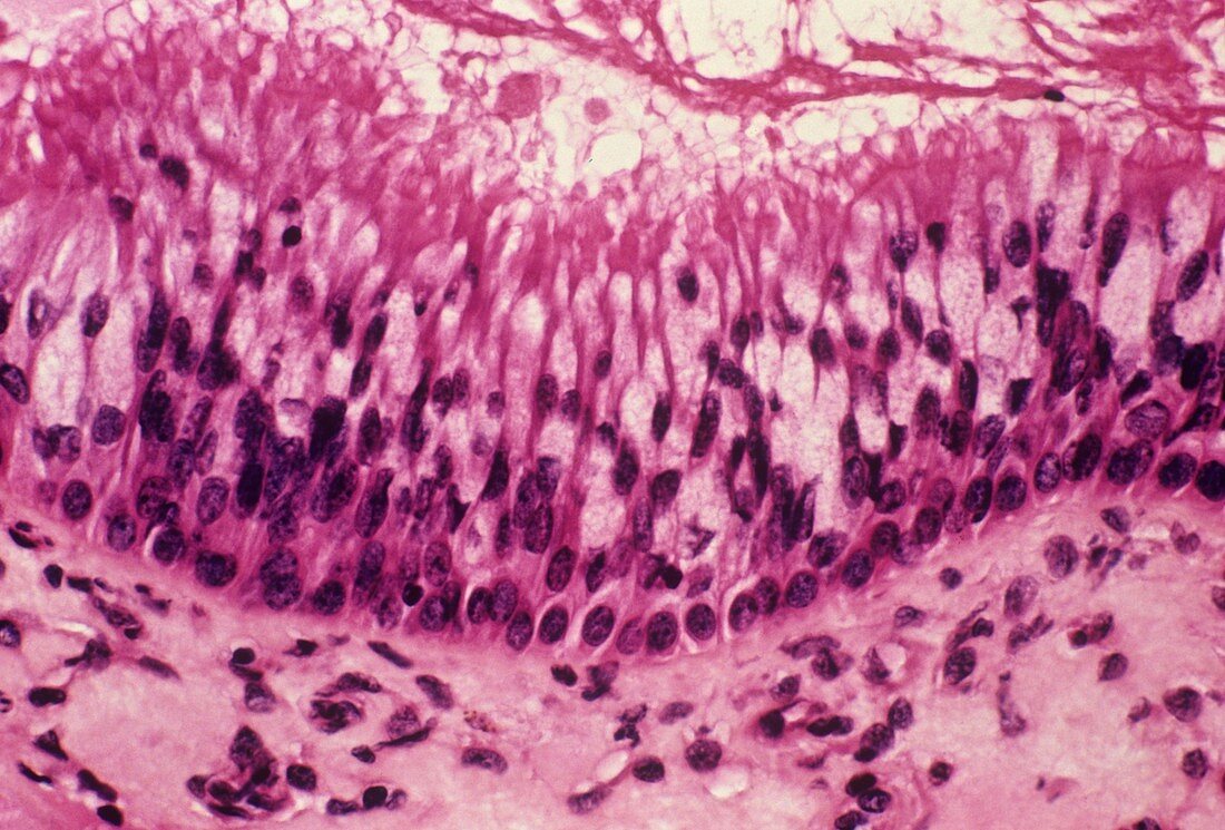 Maxillary sinus membrane