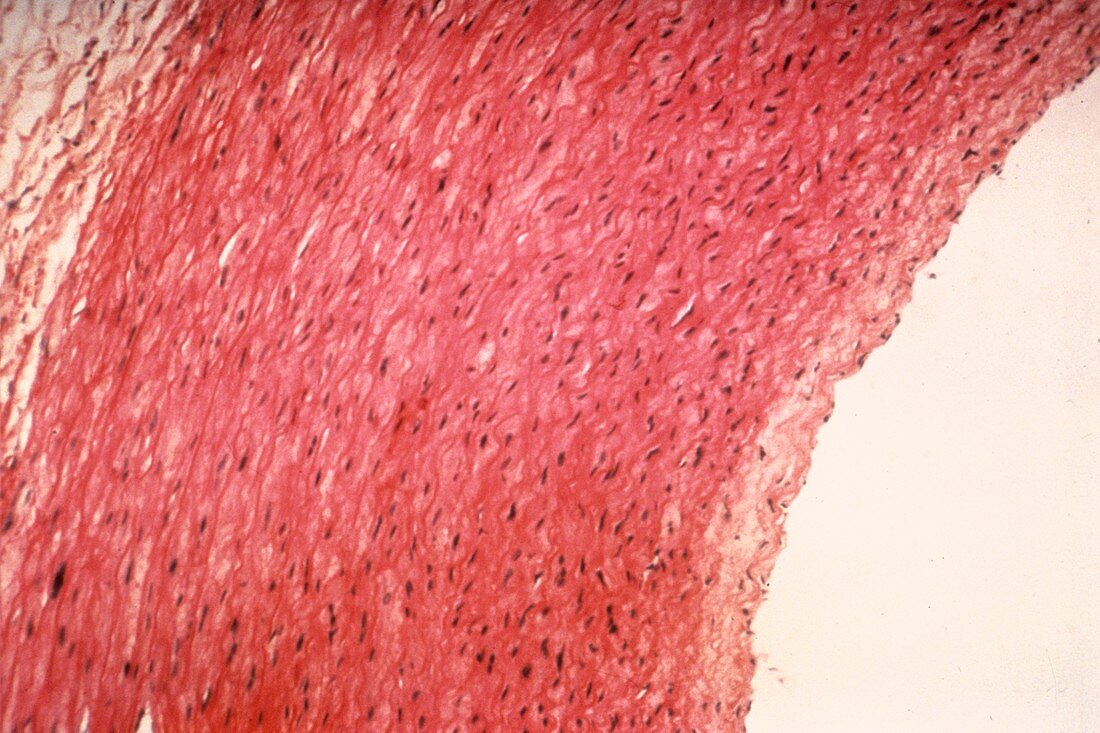 Pulmonary artery,light micrograph