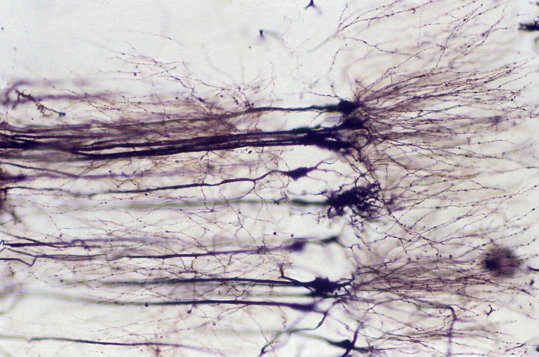 Nerve cells,light micrograph