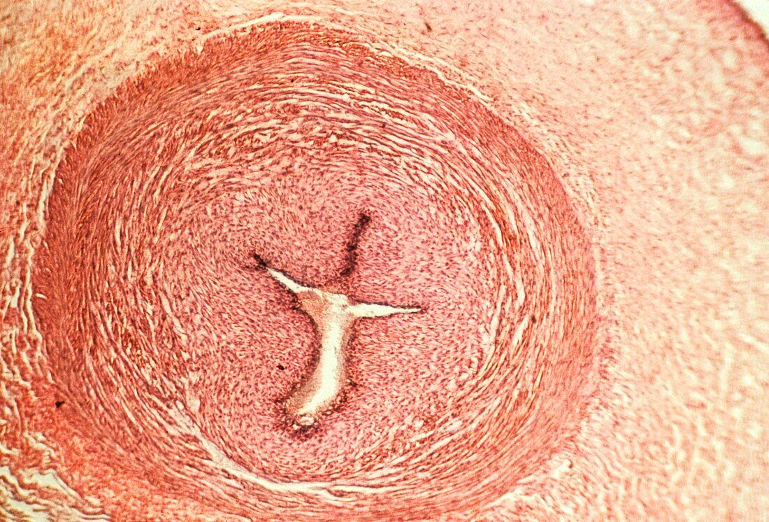 Umbilical vein,light micrograph