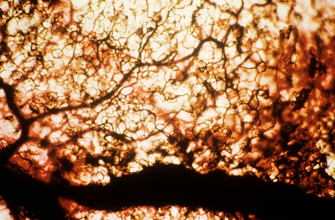 Intestinal capillaries,light micrograph