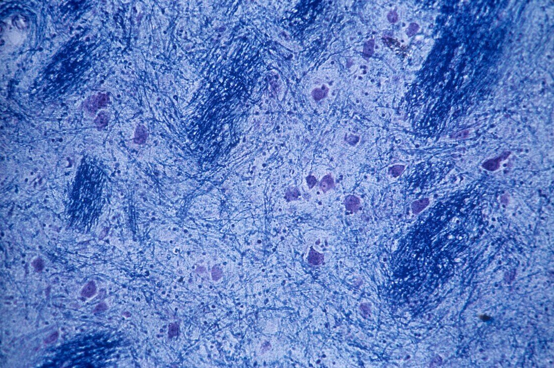 Thalamus nerve cells,light micrograph