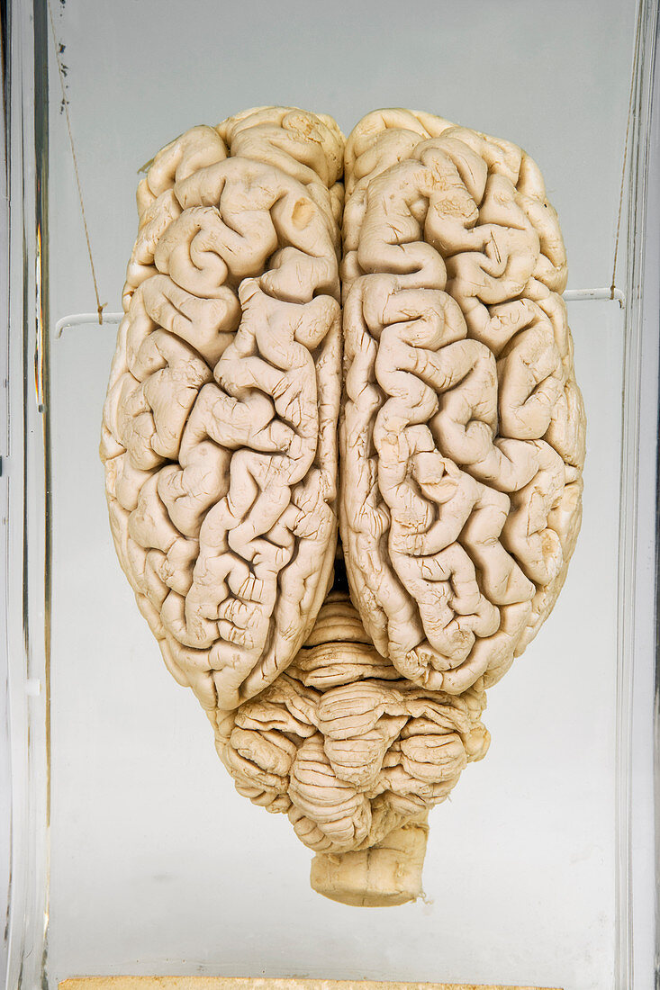 Pig brain,specimen