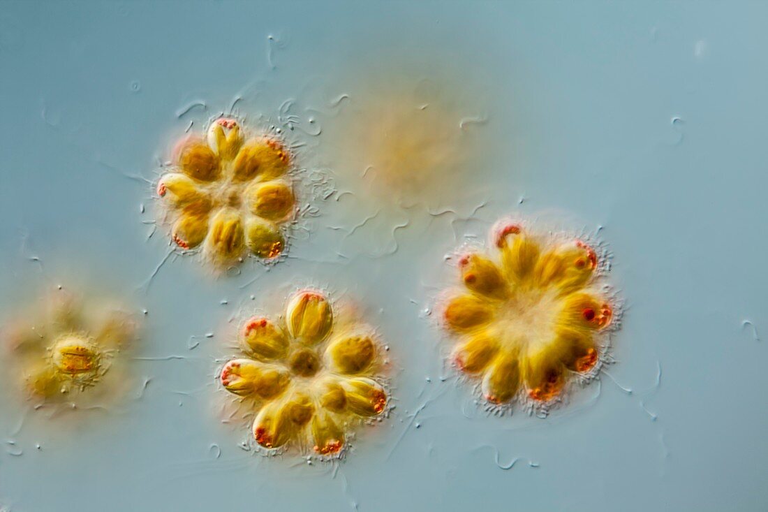 Synura alga colonies,LM