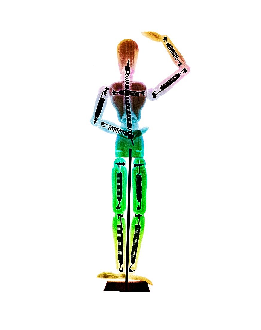 Dancing toy,X-ray