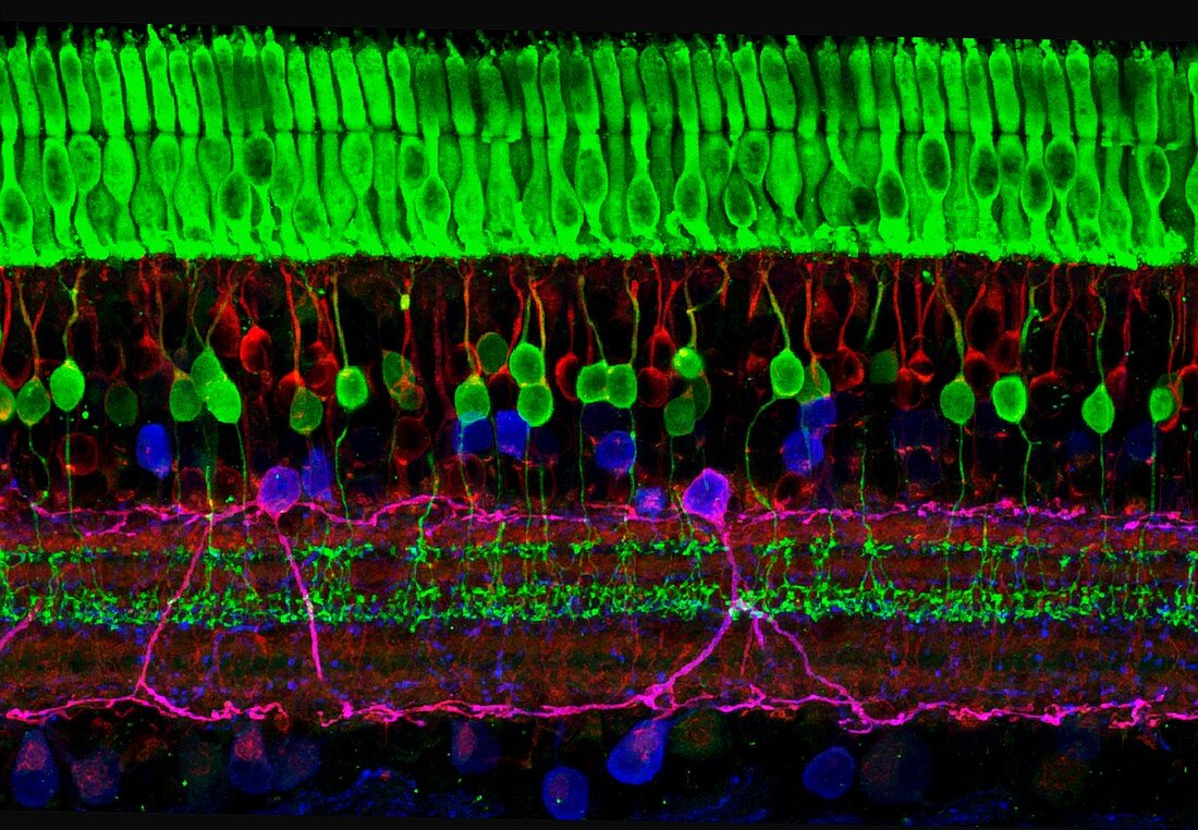 Retina of the eye,light micrograph