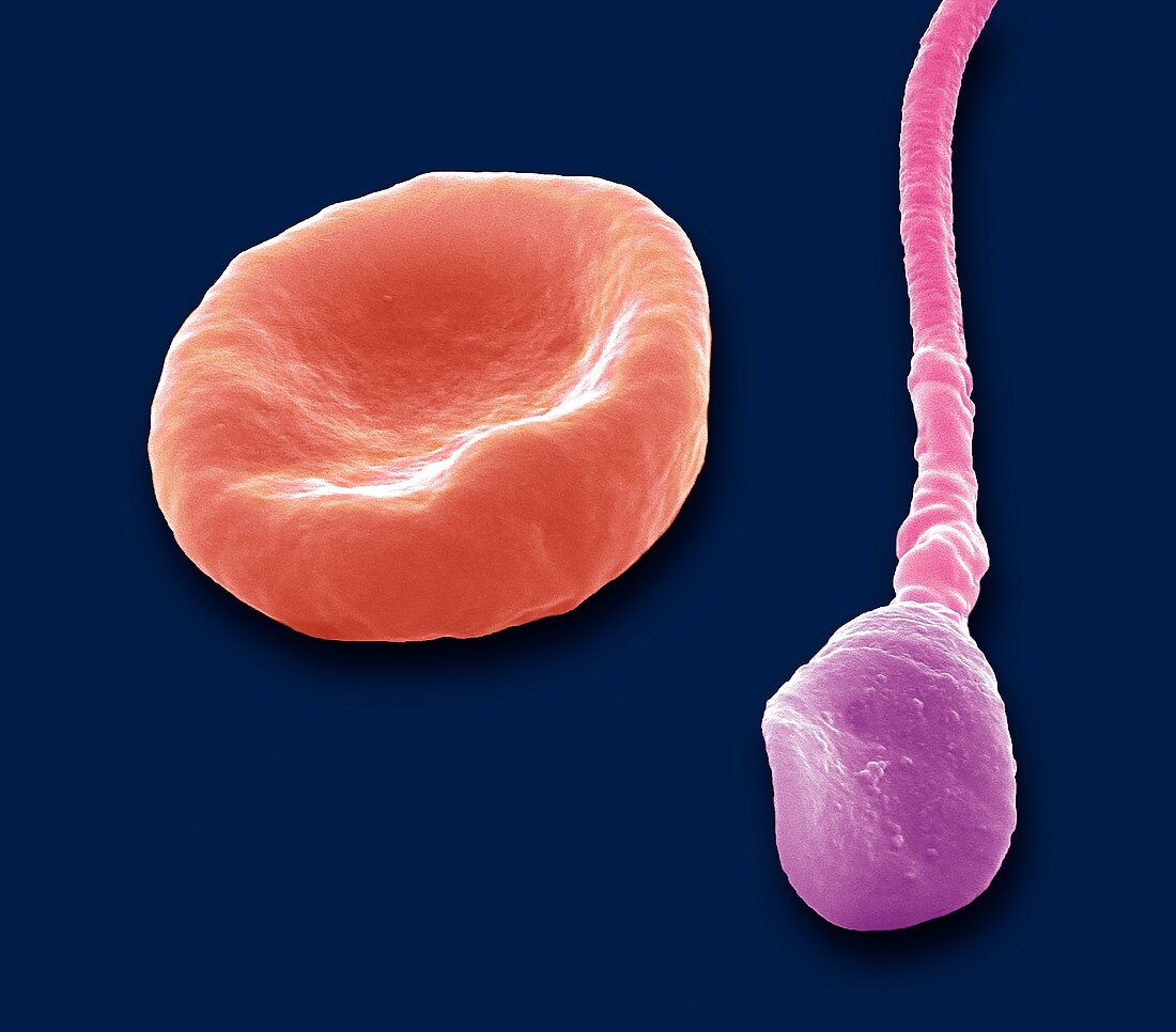 Red blood cell and sperm,SEM