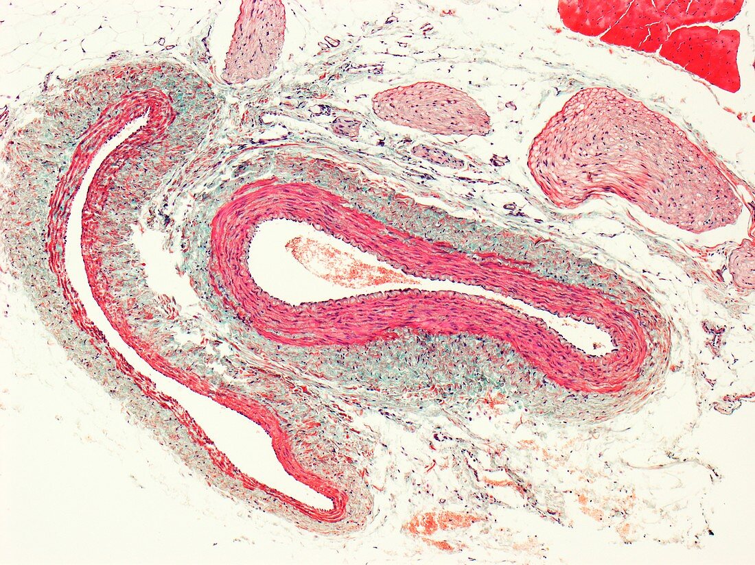 Blood vessels,light micrograph