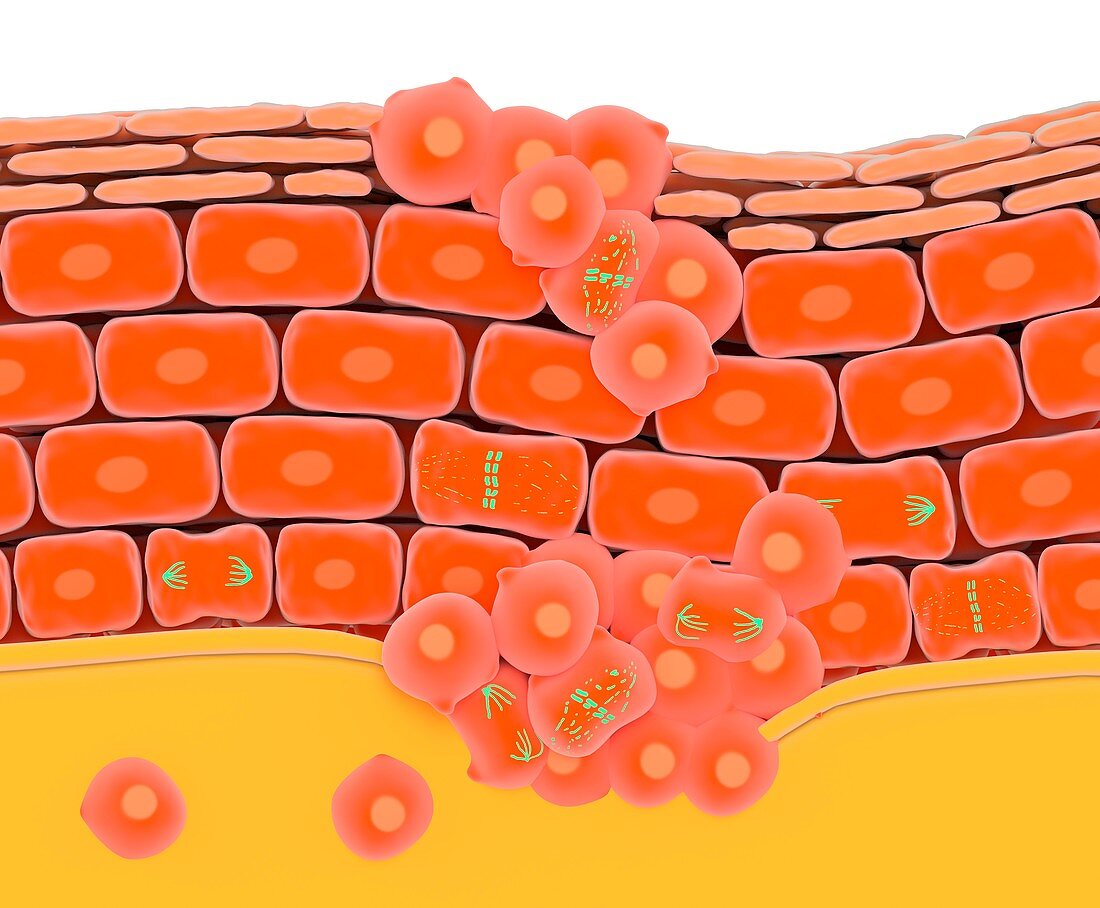 Cell division during skin cancer