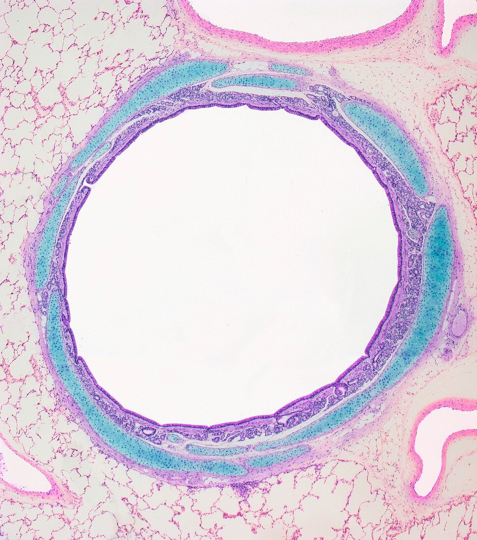 Lung bronchus,light micrograph