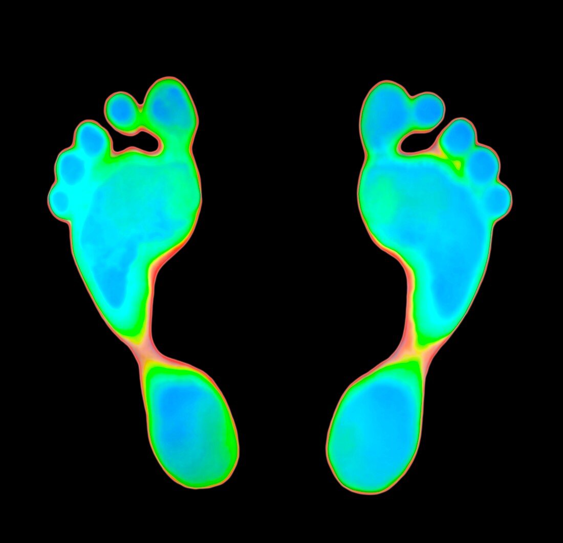 Feet prints on thermochromic film