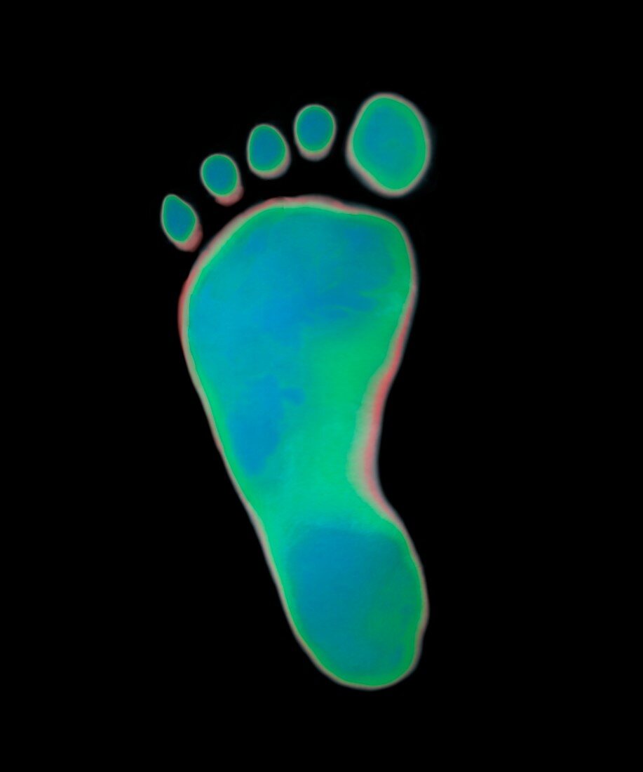 Child's footprint on thermochromic film