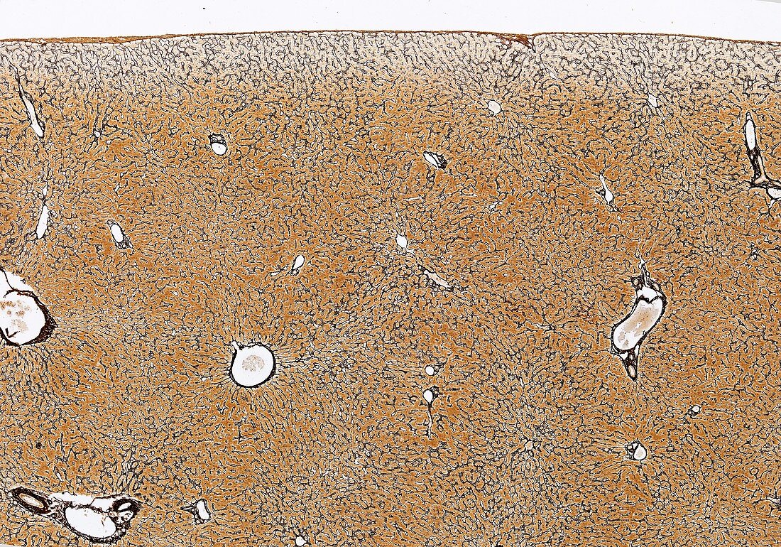 Liver,light micrograph