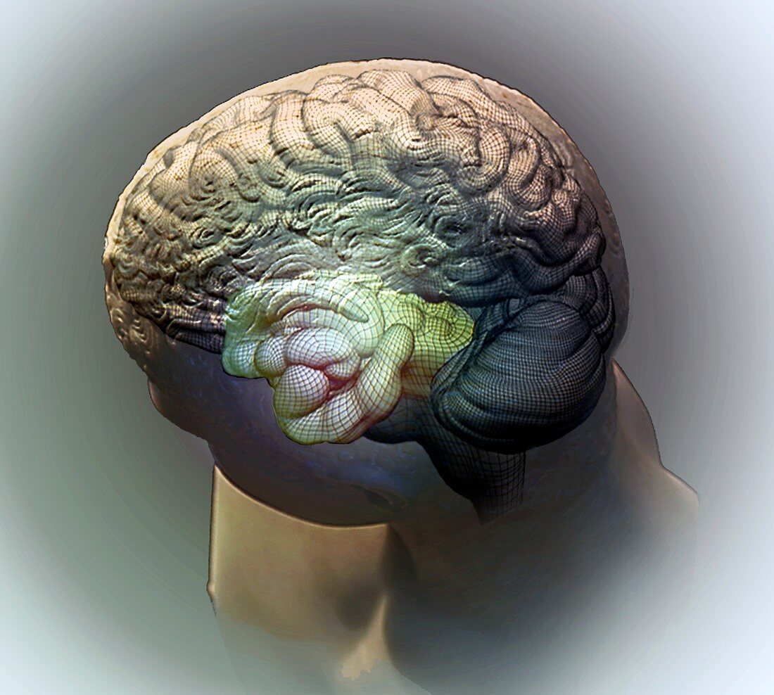 Brain and hippocampus,3D CT scan