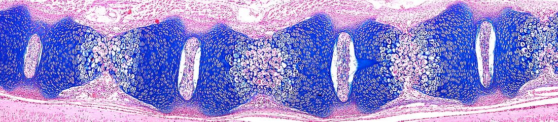 Fetal vertebral column,light micrograph