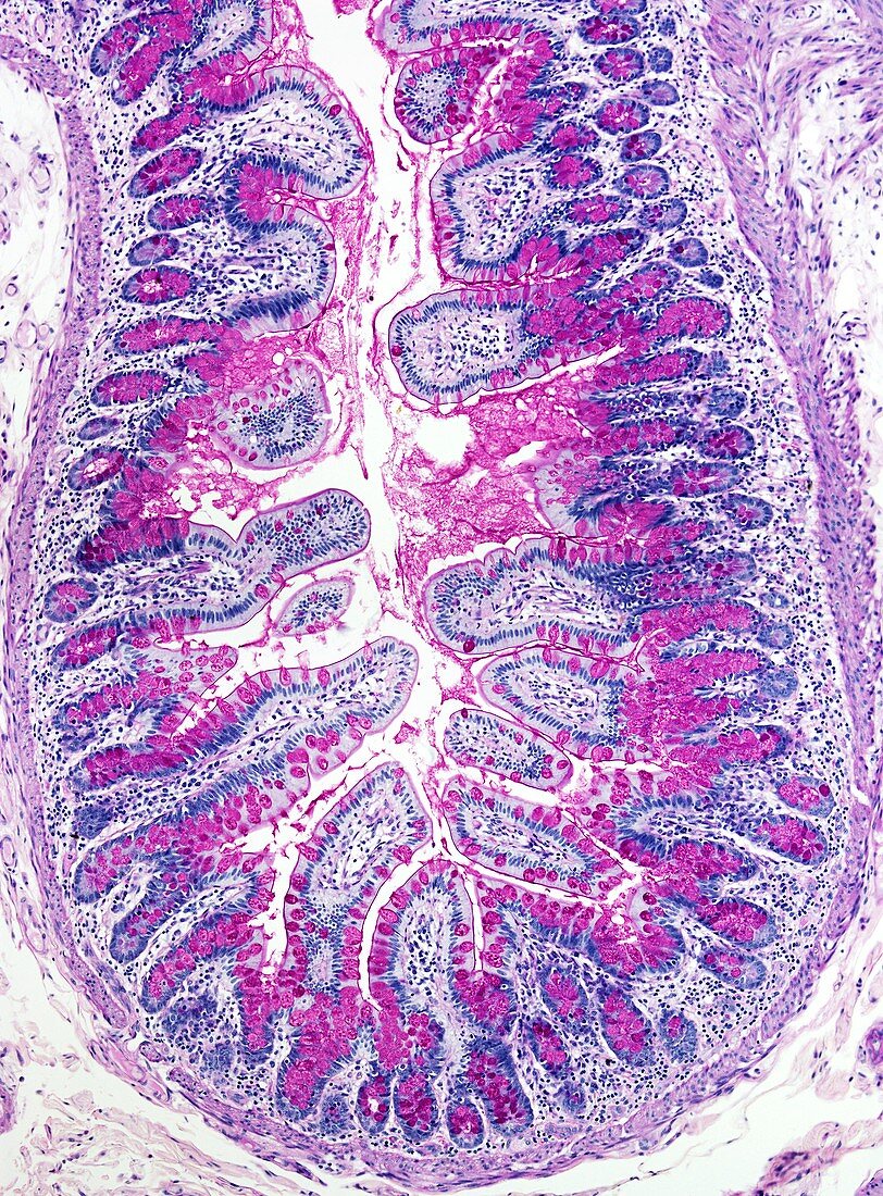 Small bowel,light micrograph