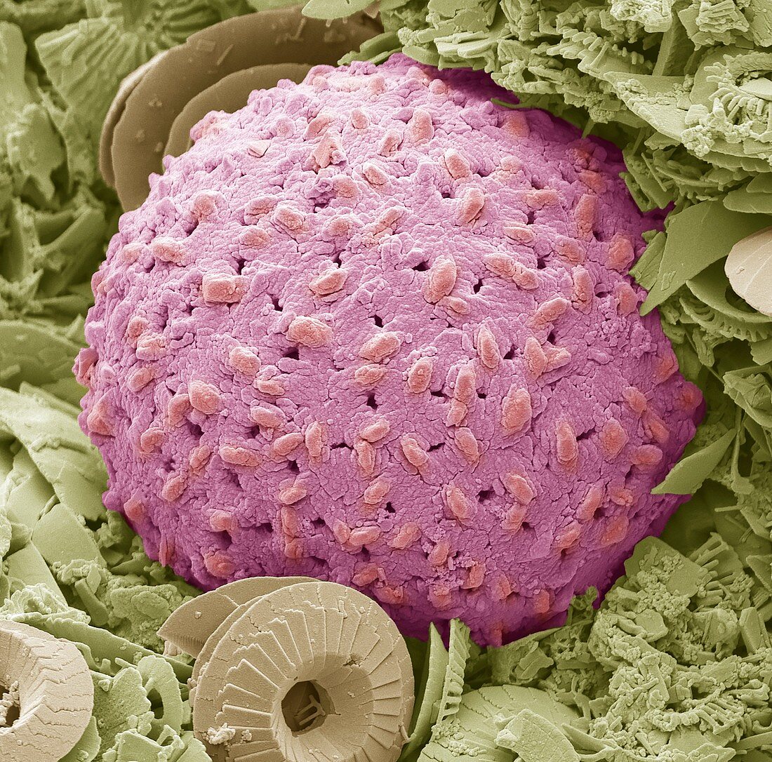 Dinoflagellate protozoan,SEM