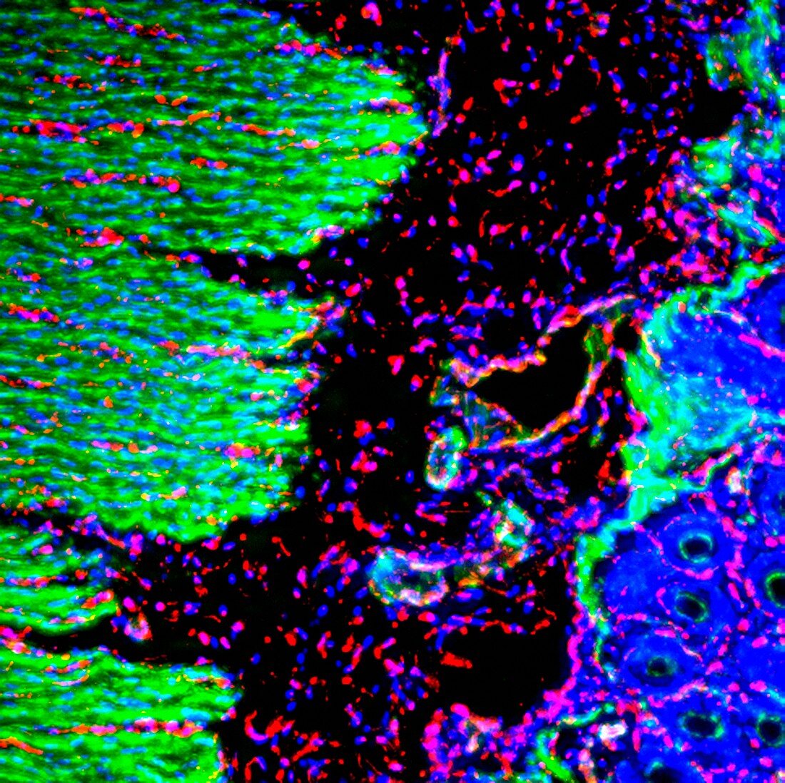 Intestinal wall,fluorescent micrograph