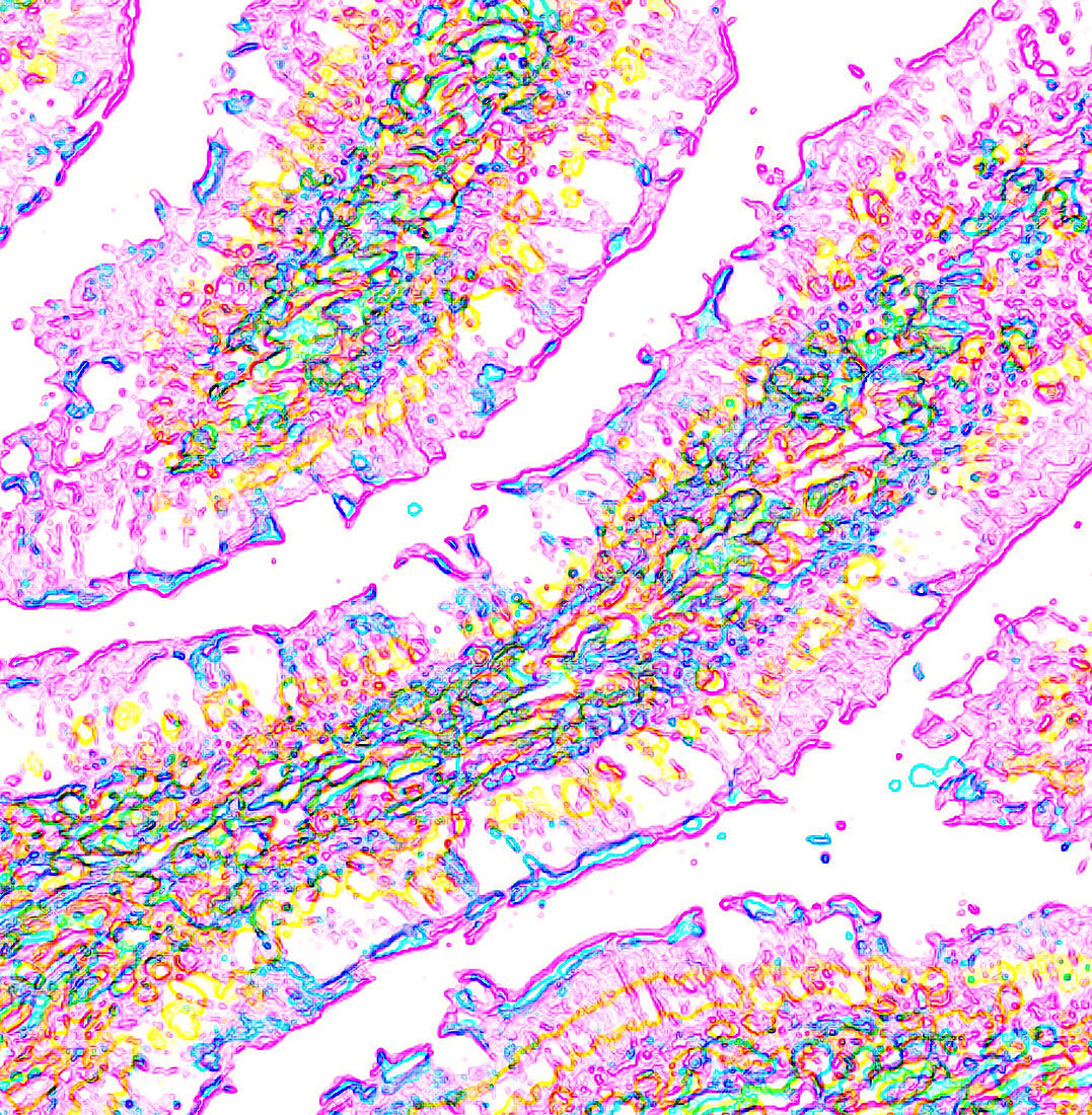 Intestinal villi,fluorescent micrograph