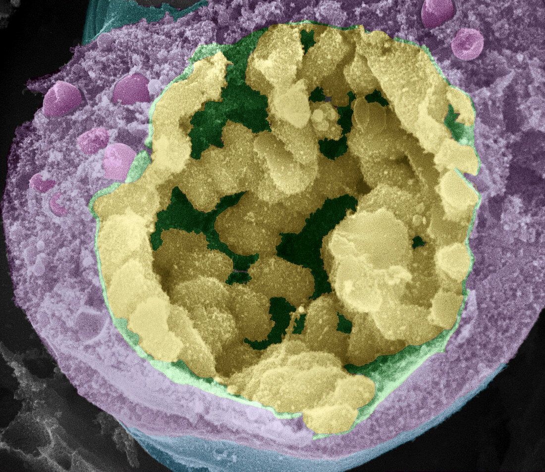 Dividing pollen cell,SEM