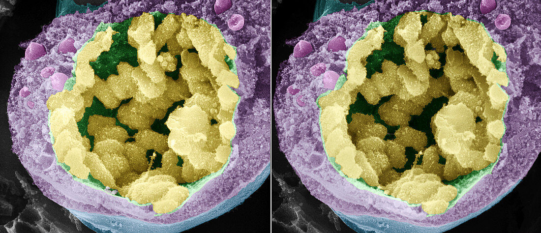 Dividing pollen cell,stereoscopic SEM