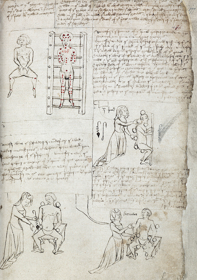 12th Century medical manuscript
