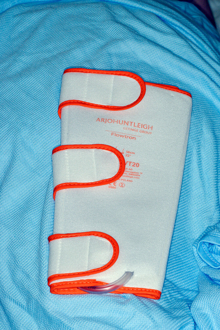 Surgical pneumatic compression sleeve