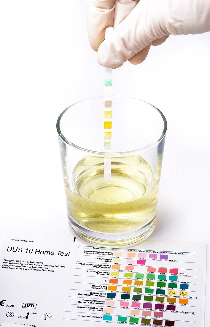 Urine home test kit