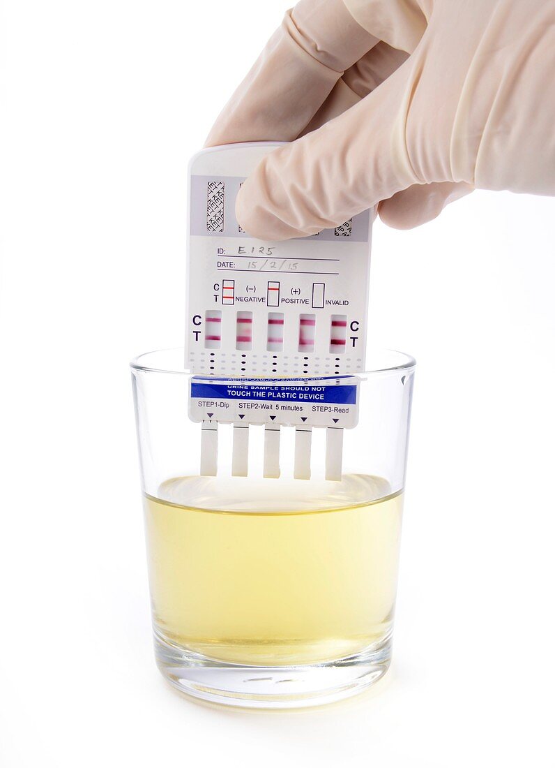 Urine drug test