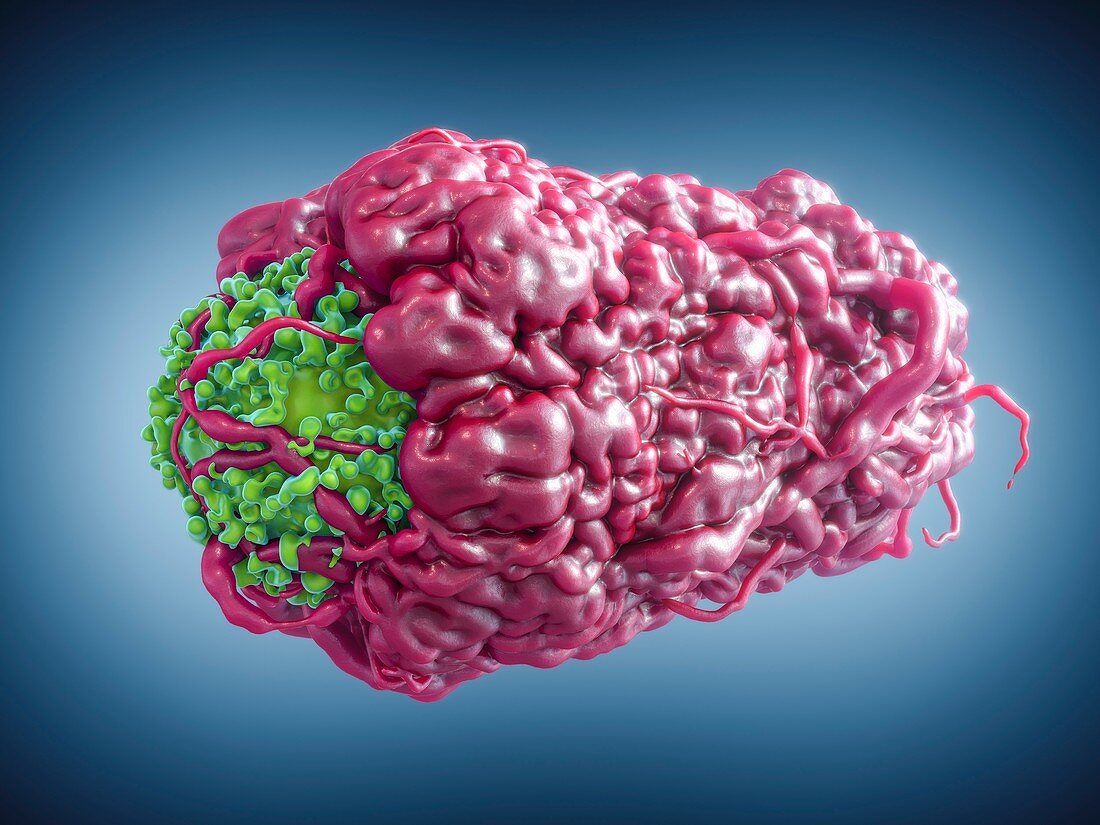 Macrophage engulfing cancer cell