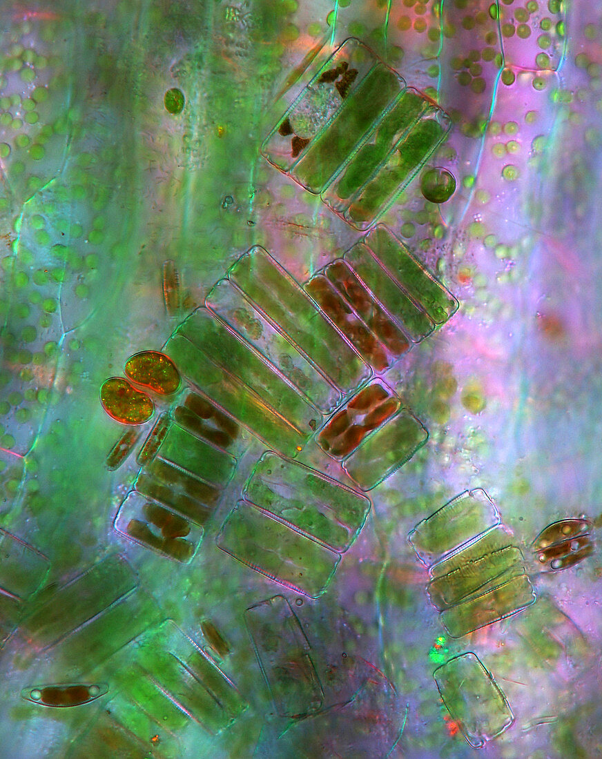 Diatoms,polarised light micrograph