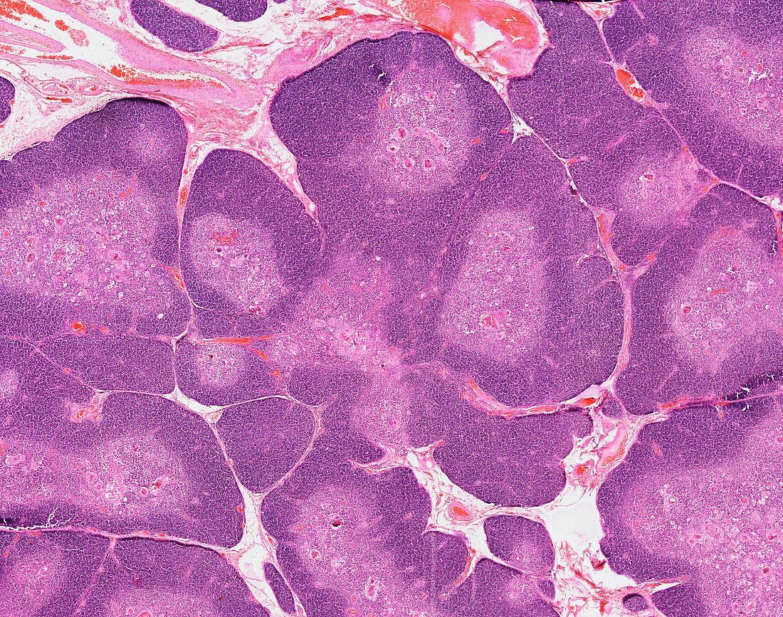 Thymus gland,light micrograph