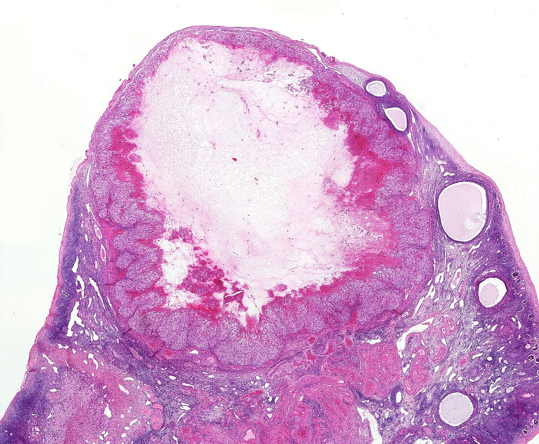 Ovary,light micrograph