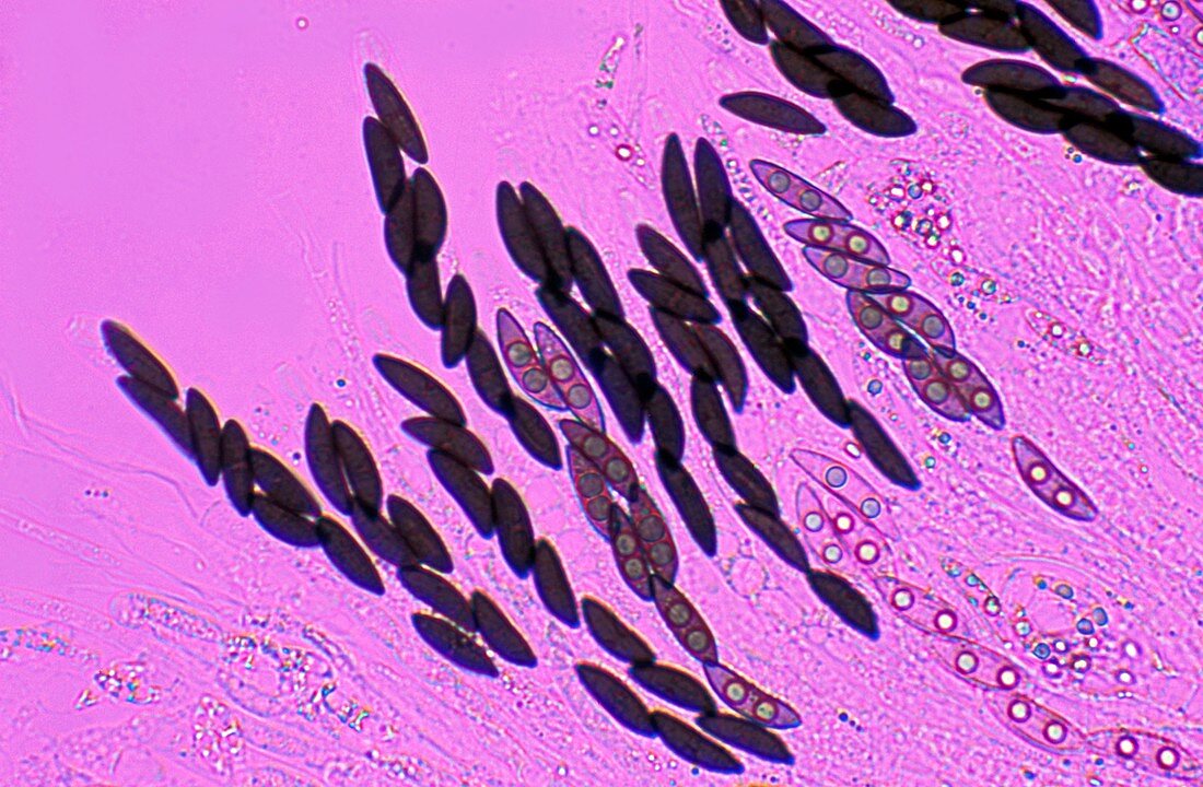 Ascomycete spores,light micrograph