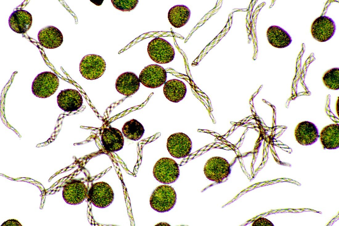 Liverwort (Pellia epiphylla) spores