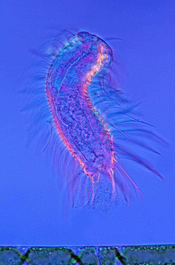 Gastrotrich,light micrograph