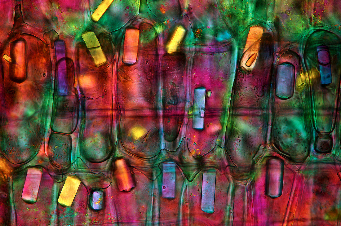 Onion skin,light micrograph