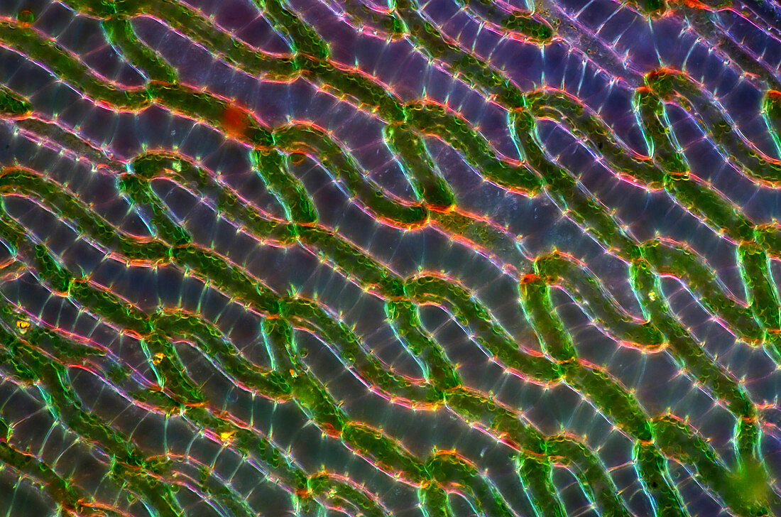 Sphagnum moss,light micrograph