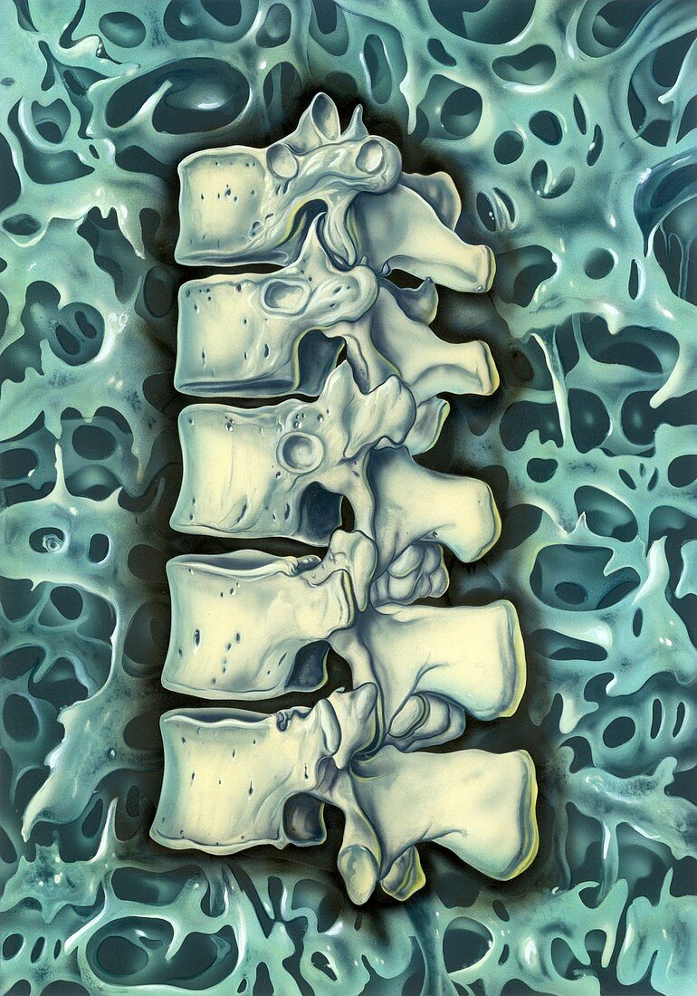 Structure of bone,illustration
