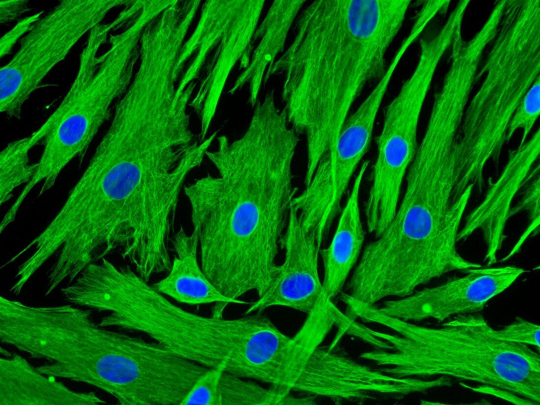 Hair follicle cells,light micrograph