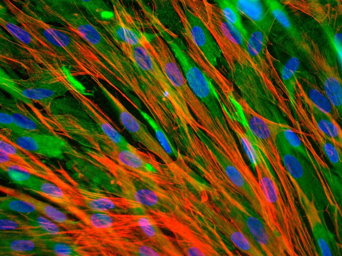 Skeletal muscle cells,light micrograph